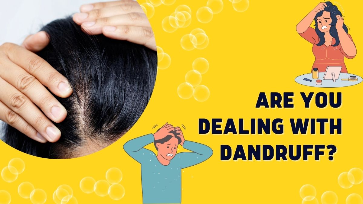 Dealing With Dandruff? Top 5 Oils You Can Include In Your Haircare For Clean Mane [Video]